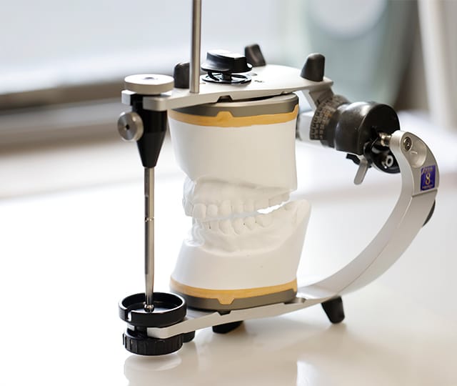 咬合器にセットされた歯型模型